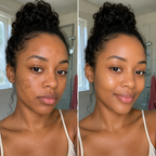 Dark Spot Correcting Serum