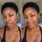 Dark Spot Correcting Serum
